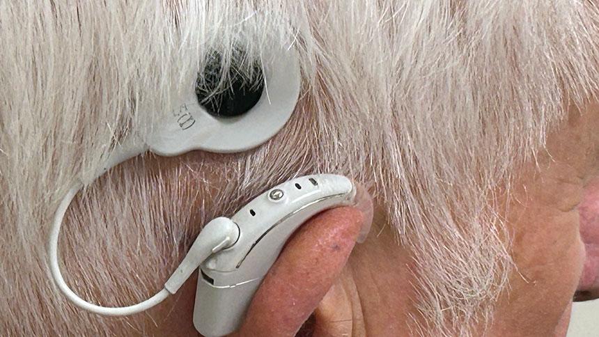 Close-Up Of Dave Modrell's Cochlear Implant