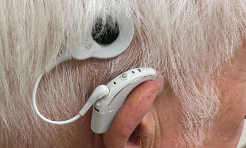 Closeup Of Cochlear Implant